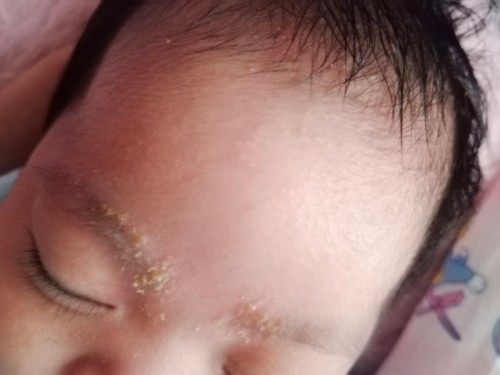 Help!! Sa mga mommies na naka experience nito!
