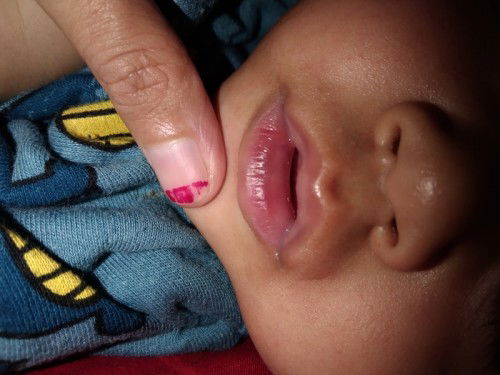 LEBAM DI BIBIR BAWAH