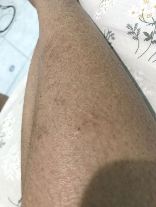 Kulit jadi kusam siap lahiran