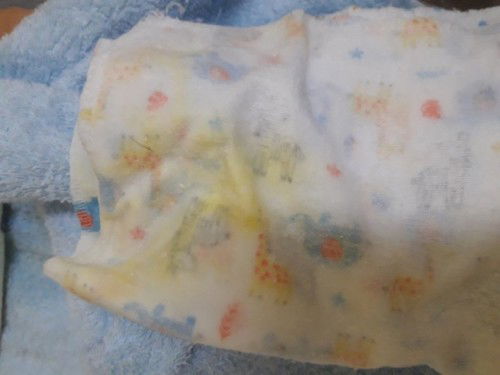 1 เดือน 18 วัน อ้วกเหลืองคืออะไรค่ะ 
อันตรายหรือปาติ ไหม
เป็นห่วงลูกค่ะ