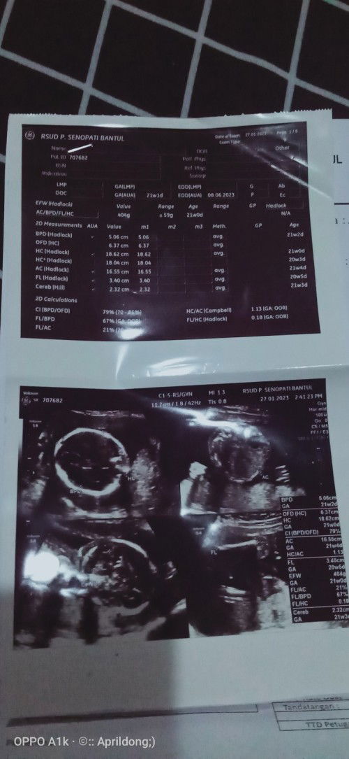 Hasil usg anak pertama