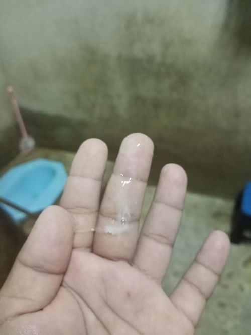 ขอถามแม่ๆใครรู้บ้างค่ะว่านีคืออะไรคือตอนนีแม่ท้องได้38+1อาบน้ำเสร็ดอยู่ๆก็มีอะไรออกมาตามที่เห็นเลยค่