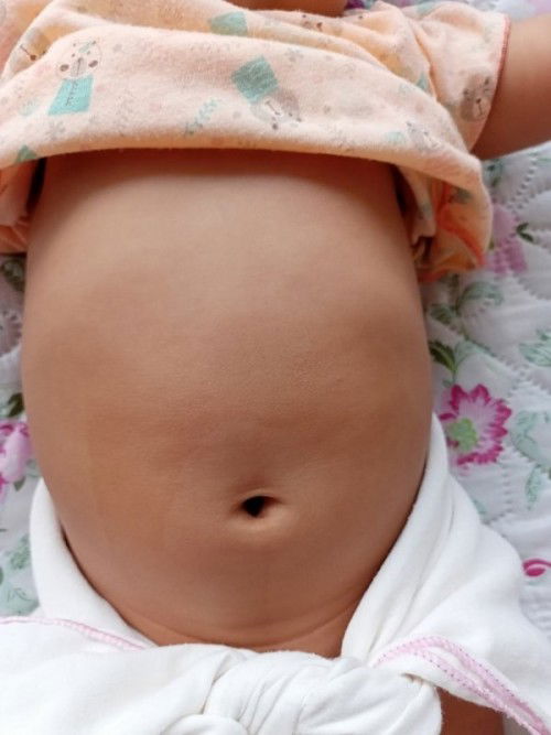 ท้องของทารก