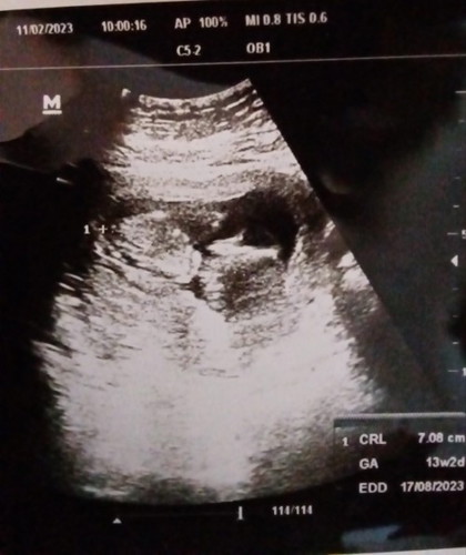 สสสอบถามค่ะ