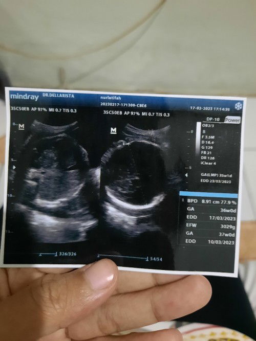 HPL maret 2023 ( 35w2d )