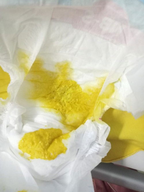 Pup bayi normal atau tidak