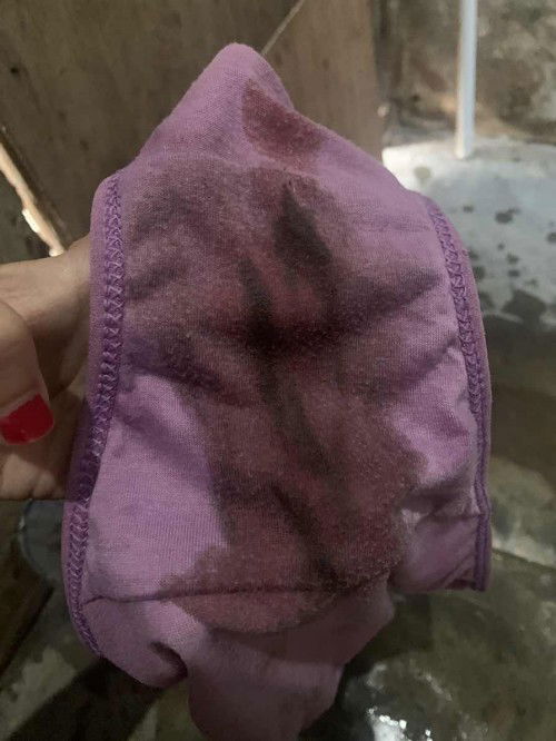 Pendarahan saat hamil muda