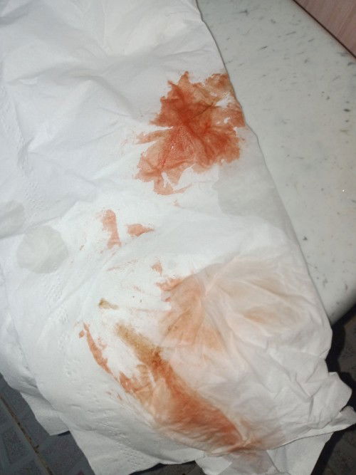 Implantation po ba ito or regla?