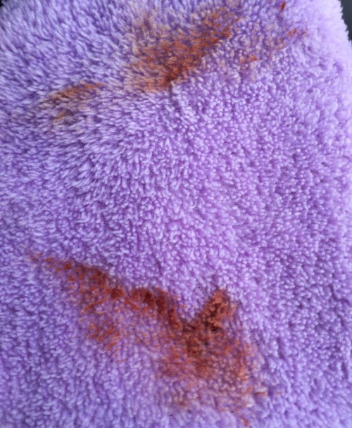 มีใครเคยเลือดออกตลอดการตั้งครรภ์บ้างไหมคะ