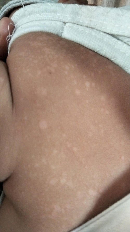 cream apa ya yg manjur