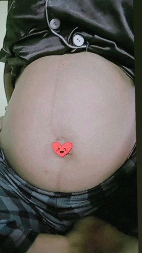 อยากชวนแม่ๆ มาอวดพุง กันหน่อยค่ะ