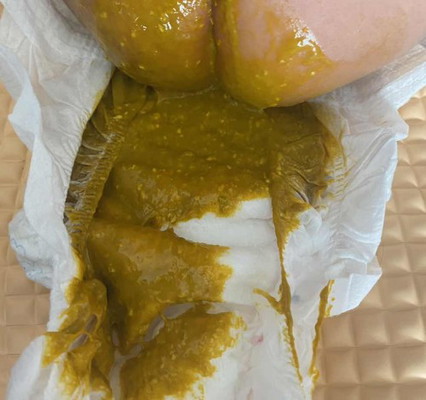 najis bayi 2bulan