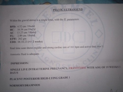 Normal lang po ba lahat?