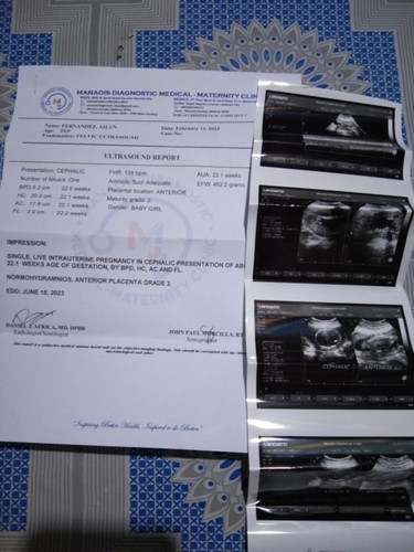 Delikado po ba ung anterior placenta