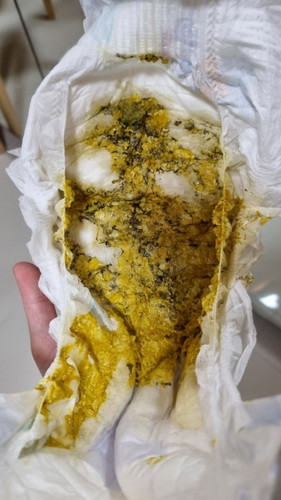 Is this normal? 7 month old poop