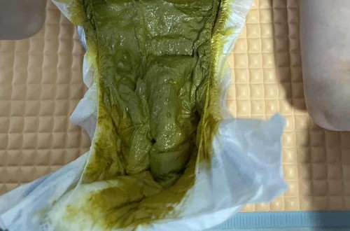 Nak tnya normal ke ? Ank 2 month full fm.. susu similac.. 3 hari bru poo.. xde meragam ap cuma risau