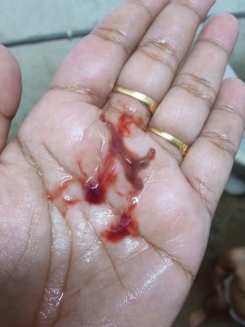 Ini spoting@haid??
Last piriod 20/1/2023
Ikotkn dah lewat 3hari tak Mai (piriod)