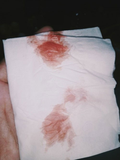 Tespek positif samar tapi kluar darah kaya haid