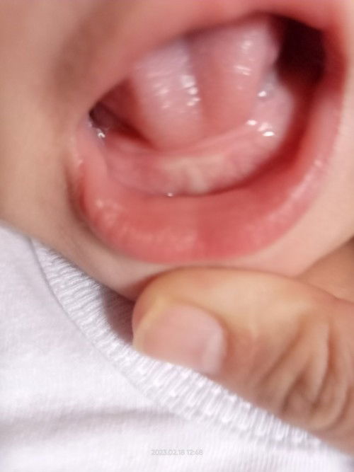 Goodmorning po mga ka momshie ask ko lang po anu kaya yan nasa gilagid ng baby ko 4mons palang sya😌