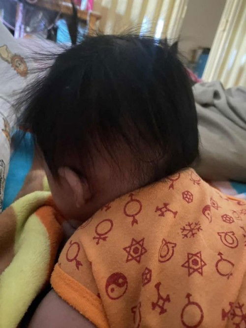 น้องผมร่วงแต่ตรงนี้เกิดจากอะไรค่ะ???