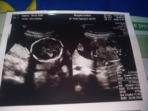 Assalamualaikum bunda²