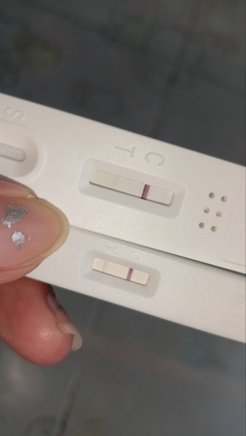 Is it normal po ba na mag-bleeding after I found out na positive yung pt?