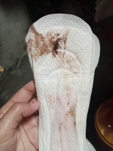 Dark brown discharge