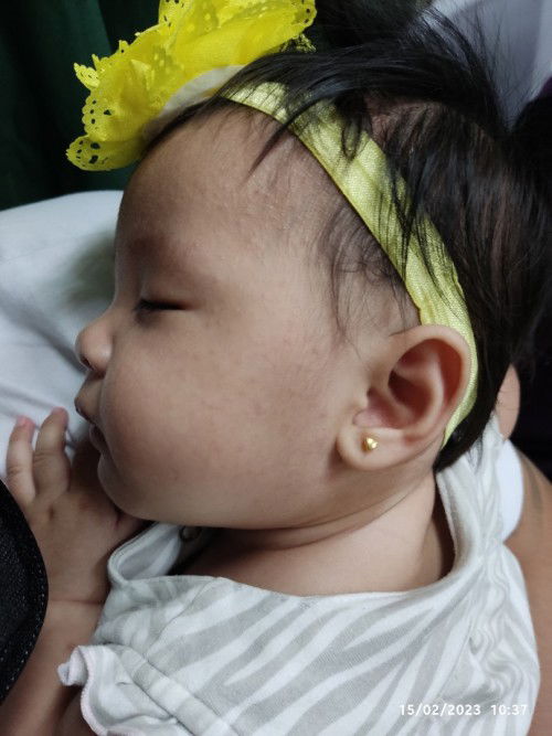 Cetaphil caused rashes to my baby