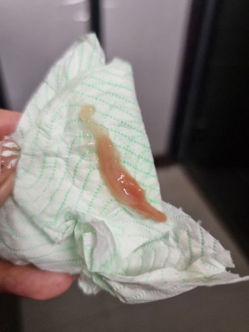 Is this mucus plug? 21w pregnant