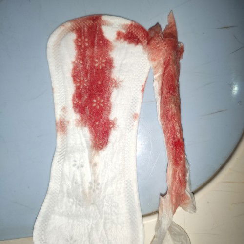 Bloody show or dahil lng sa IE?@