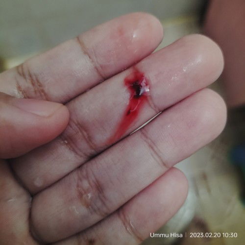 Janin masih aman atau tidak?