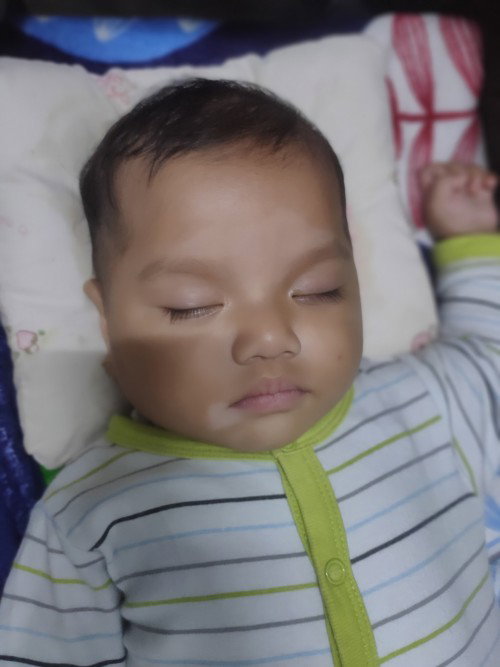 Kulit putih2