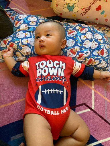 Bayi 5 bulan sering garuk² kepala