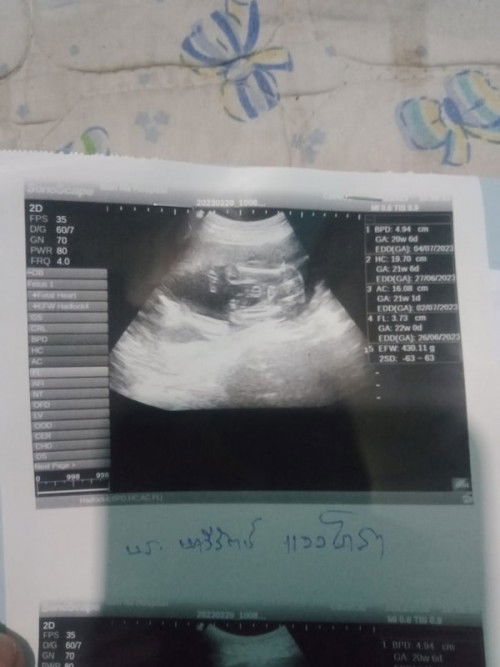 21+3สัปดาห์แล้ว ไปซาวด์มาแล้ว แต่หมอไม่ได้บอกเพศ แบบนี้รู้เพศยังคะ