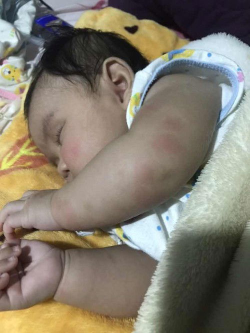 เกิดจากอะไรคะมีแม่ๆท่านไหนทราบบ้าง