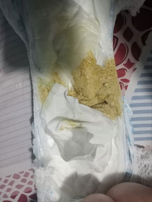 Nestogen to Bonna Formula