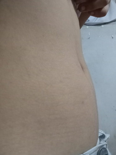 หนูท้องป่าวค่ะแม่ๆช่วยดูหน่อยค่ะ