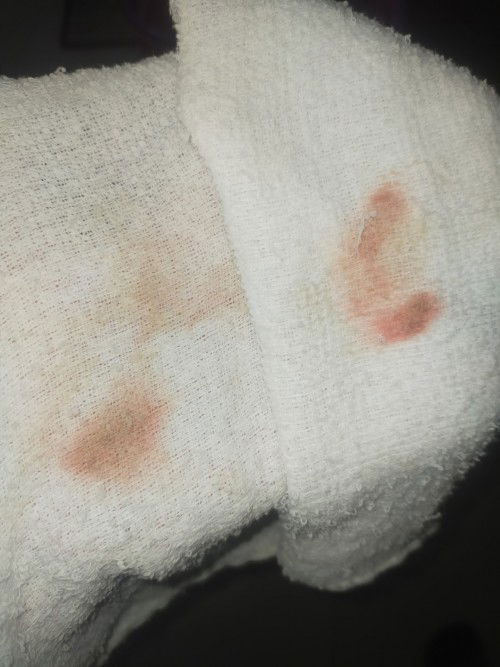 Meron po bang nagspotting dito nung 7weeks po sila ?