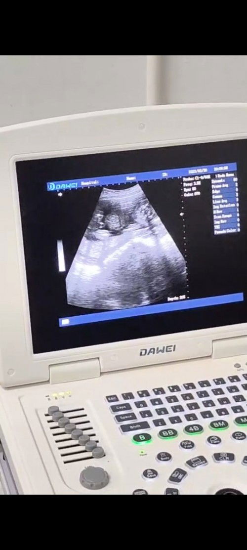 ลูกชายหรือลูกสาว