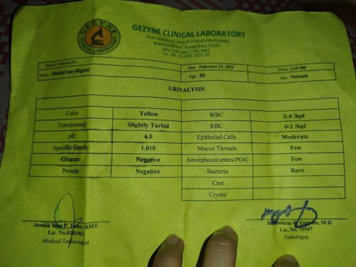 Ask kolang po kung may uti poba ako?