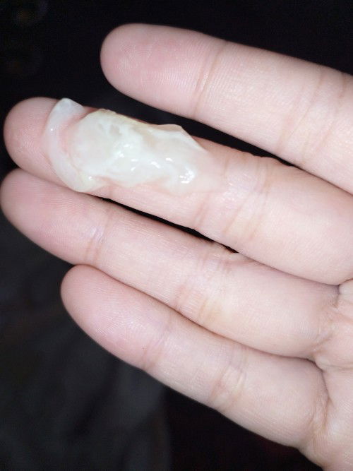 White jelly discharge