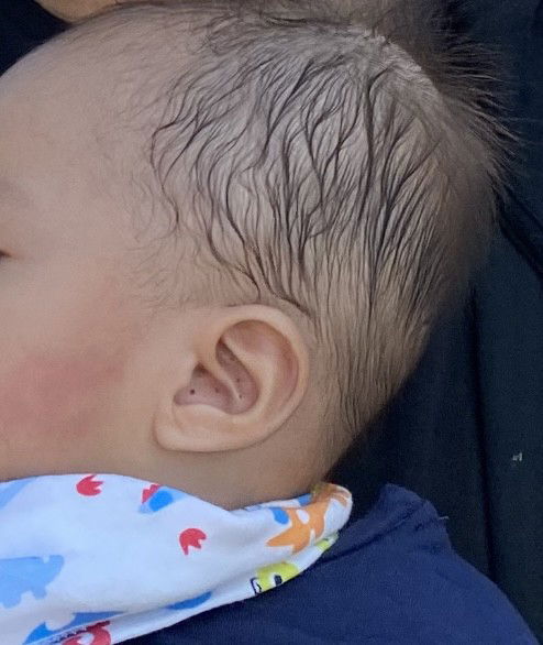 Bayi menggaruk telinga