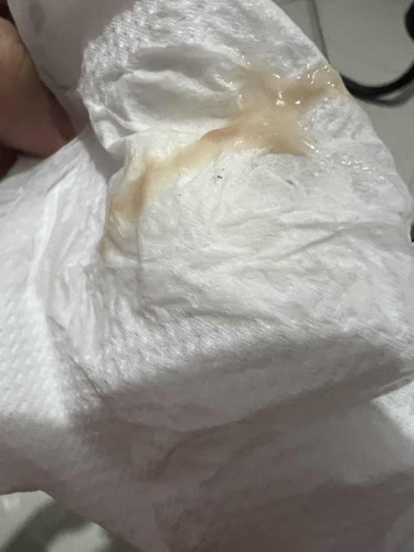 Mucus plug na ba ito?