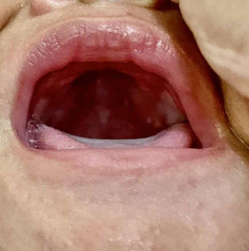 putih putih di langit mulut