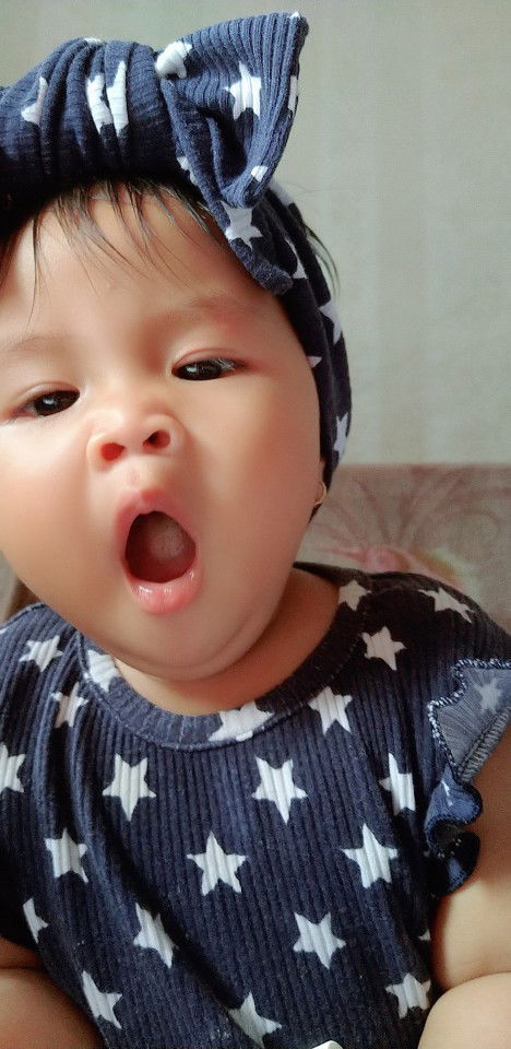 Lidah bayi putih