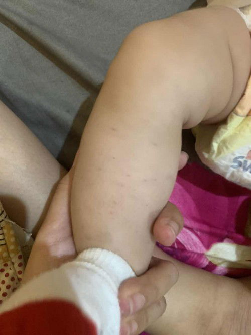 Bintik merah di kaki