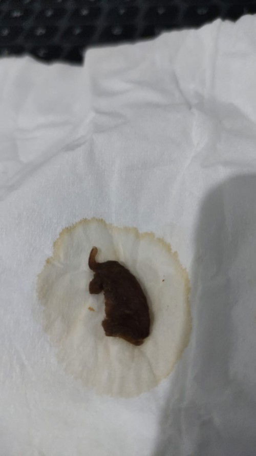 Flek saat hamil muda