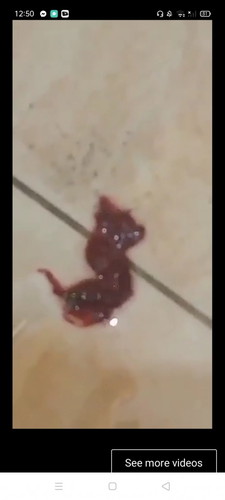 hello po pwede puba mag tanong bakit may may buo buong dugo na lumabas? dalawang magkasunod