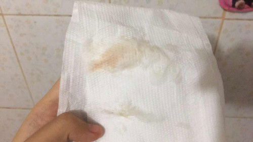 เข้า37วีคแล้วค่ะ แบบนี้มูกใสใช่ไหมแต่เหมือนจะมีเลือดปนๆอยู่ด้วย แต่ไม่ปวดท้องนะคะ #ขอบคุณสำหรับคำตอบค่ะ #คุณแม่ๆช่วยแนะนำหน่อยค่ะ