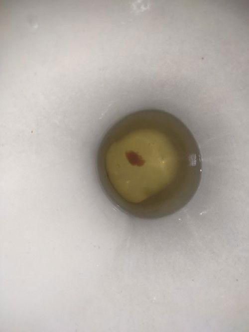 Pa help naman po nakita ko kanina pag ihi ko 8weeks and 5days pregnant